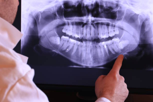 Best Emergency Treatment for Dental Infections or Abscesses in Dallas, TX