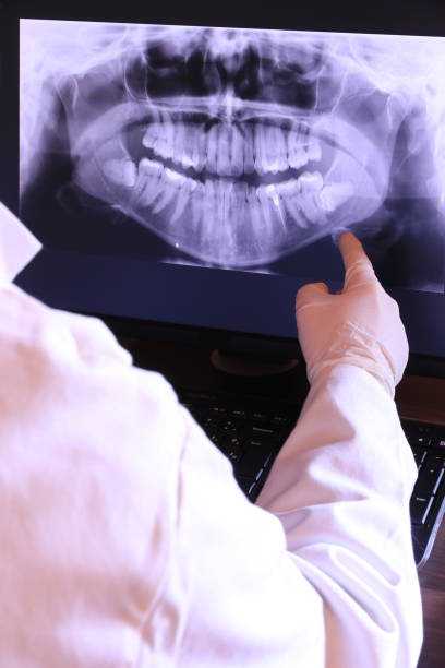 Best Emergency Dental Care for Broken or Chipped Teeth in Dallas, TX