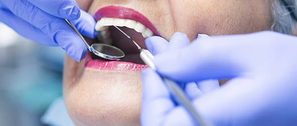 Best Emergency Tooth Extraction in Dallas, TX